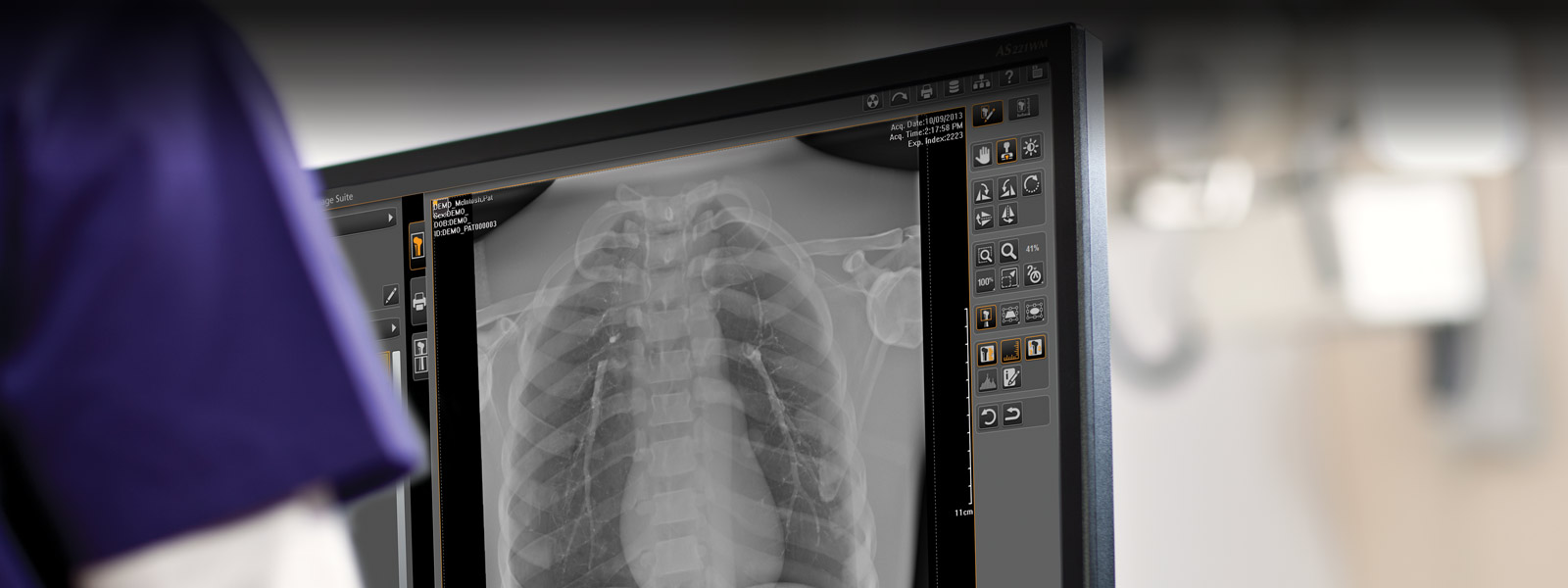 CARESTREAM Image Suite 软件